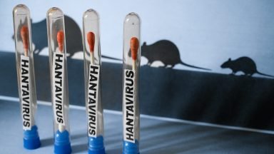 Is Hantavirus Contagious? Outbreak Updates, Treatment Information & Mortality Rate